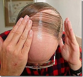 bald-hairstyle-bad-12